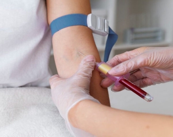 Blood Test Done at Home